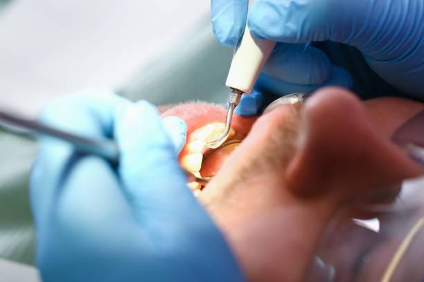 Best Dental Abscess Treatment in Waverly, MN