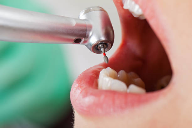 Best Emergency Treatment for Oral Infections in Waverly, MN